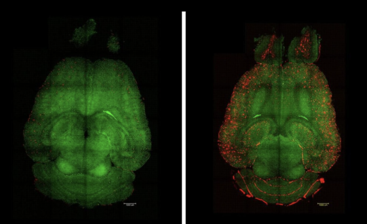 Os cientistas conseguiram reverter a doença de Alzheimer em ratos.